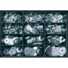 Coffret E-NORM 12 K-Scheibe zn